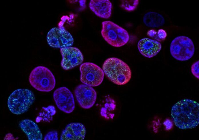 First long-term study to look at cancer in Asian Americans – AsAmNews