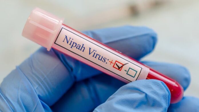 Nipah virus