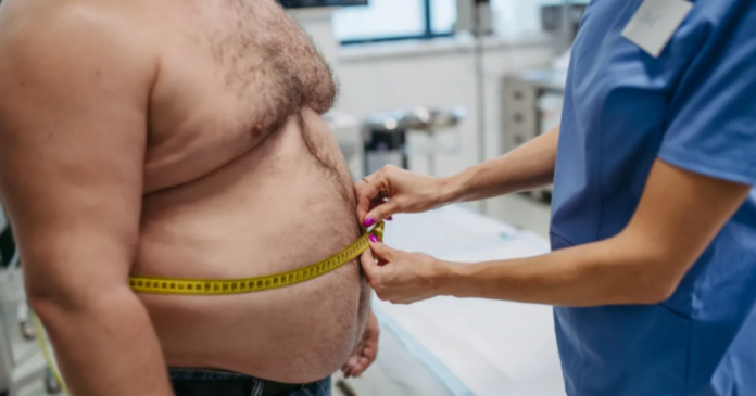 Obesity drains $45b annually from Australia’s economy